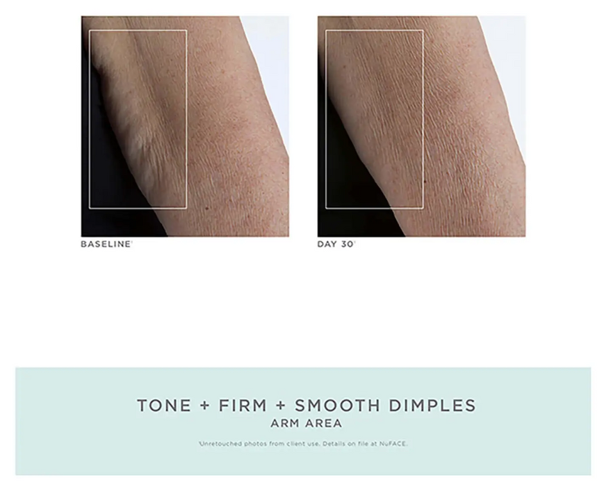 NuBODY Body Skin Toning Device