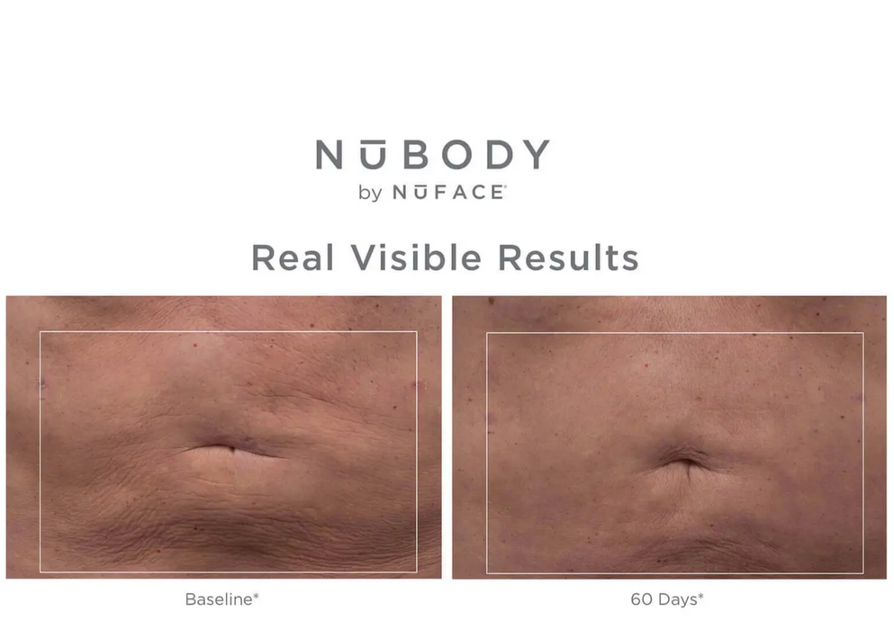 NuBODY Body Skin Toning Device